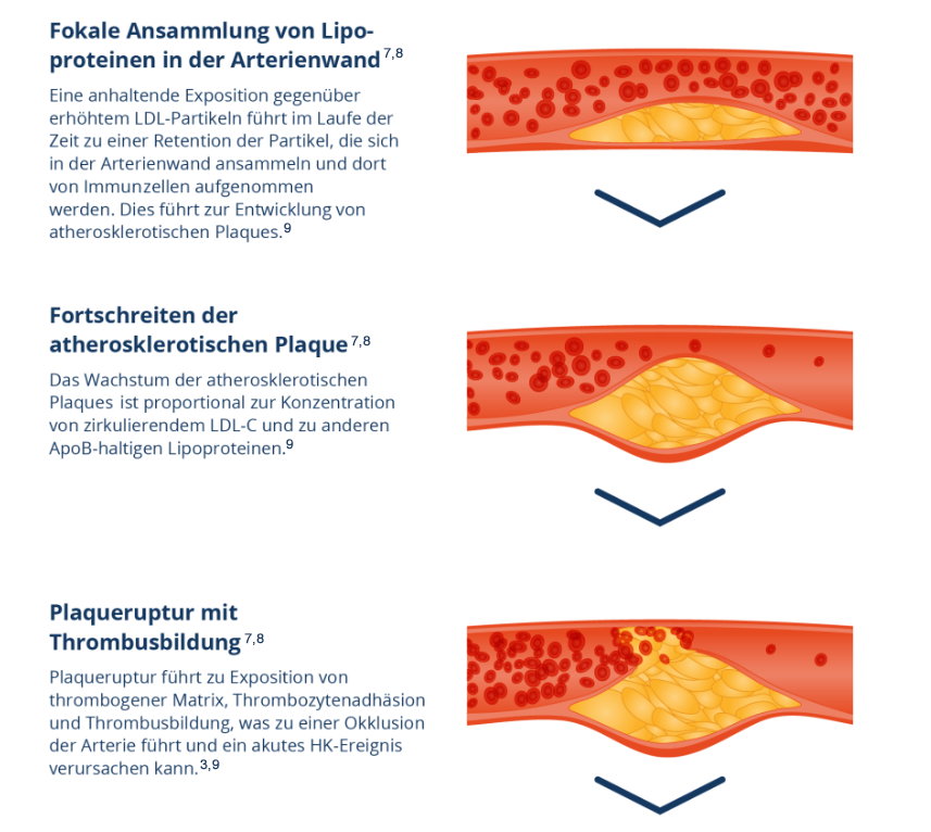 Entstehung von Atherosklerose